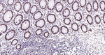 ILF3 Antibody in Immunohistochemistry (Paraffin) (IHC (P))