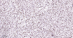 ILF3 Antibody in Immunohistochemistry (Paraffin) (IHC (P))