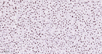 ILF3 Antibody in Immunohistochemistry (Paraffin) (IHC (P))
