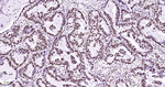 ILF3 Antibody in Immunohistochemistry (Paraffin) (IHC (P))