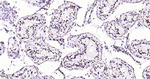 ILF3 Antibody in Immunohistochemistry (Paraffin) (IHC (P))