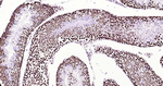 ILF3 Antibody in Immunohistochemistry (Paraffin) (IHC (P))