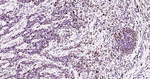 ILF3 Antibody in Immunohistochemistry (Paraffin) (IHC (P))