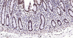 ILF3 Antibody in Immunohistochemistry (Paraffin) (IHC (P))