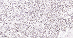 ILF3 Antibody in Immunohistochemistry (Paraffin) (IHC (P))