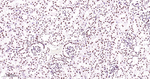 ILF3 Antibody in Immunohistochemistry (Paraffin) (IHC (P))
