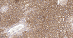 XDH Recombinant Rabbit Monoclonal Antibody (2B7)