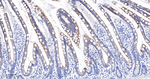 CYP27A1 Recombinant Rabbit Monoclonal Antibody (10A6)
