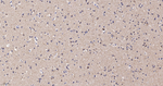 PIST Recombinant Rabbit Monoclonal Antibody (2F3)