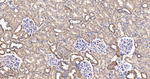 PIST Antibody in Immunohistochemistry (Paraffin) (IHC (P))