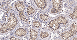 PIST Antibody in Immunohistochemistry (Paraffin) (IHC (P))