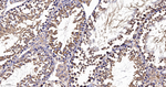 PIST Antibody in Immunohistochemistry (Paraffin) (IHC (P))