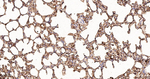 Tetranectin Antibody in Immunohistochemistry (Paraffin) (IHC (P))