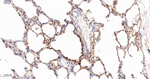 Tetranectin Antibody in Immunohistochemistry (Paraffin) (IHC (P))