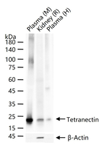 Tetranectin Antibody in Western Blot (WB)