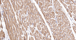NDUFA13 Antibody in Immunohistochemistry (Paraffin) (IHC (P))