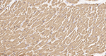 TPM1 Antibody in Immunohistochemistry (Paraffin) (IHC (P))
