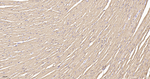 TPM1 Antibody in Immunohistochemistry (Paraffin) (IHC (P))
