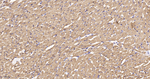TPM1 Antibody in Immunohistochemistry (Paraffin) (IHC (P))