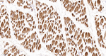 TPM1 Antibody in Immunohistochemistry (Paraffin) (IHC (P))