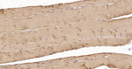 TPM1 Recombinant Rabbit Monoclonal Antibody (2B2)