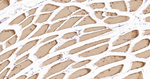TPM1 Antibody in Immunohistochemistry (Paraffin) (IHC (P))