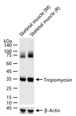 TPM1 Antibody in Western Blot (WB)