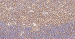 IQGAP1 Antibody in Immunohistochemistry (Paraffin) (IHC (P))