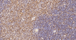 IQGAP1 Antibody in Immunohistochemistry (Paraffin) (IHC (P))