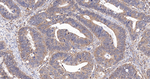 IQGAP1 Antibody in Immunohistochemistry (Paraffin) (IHC (P))
