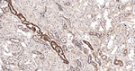 IQGAP1 Antibody in Immunohistochemistry (Paraffin) (IHC (P))