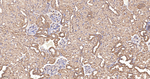 IQGAP1 Antibody in Immunohistochemistry (Paraffin) (IHC (P))