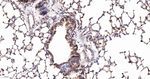 IQGAP1 Antibody in Immunohistochemistry (Paraffin) (IHC (P))