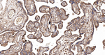 IQGAP1 Antibody in Immunohistochemistry (Paraffin) (IHC (P))