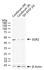 EGR2 Recombinant Rabbit Monoclonal Antibody (7H8)