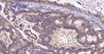 SMN1 Recombinant Rabbit Monoclonal Antibody (7B6)