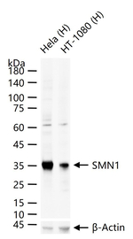 SMN1 Antibody in Western Blot (WB)