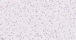 TNPO3 Antibody in Immunohistochemistry (Paraffin) (IHC (P))