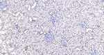 TNPO3 Antibody in Immunohistochemistry (Paraffin) (IHC (P))
