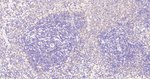TNPO3 Antibody in Immunohistochemistry (Paraffin) (IHC (P))