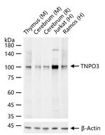TNPO3 Antibody in Western Blot (WB)