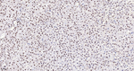 NONO Antibody in Immunohistochemistry (Paraffin) (IHC (P))