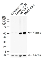 NONO Antibody in Western Blot (WB)