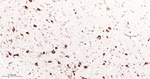 COMT Antibody in Immunohistochemistry (Paraffin) (IHC (P))