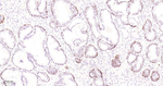 COMT Antibody in Immunohistochemistry (Paraffin) (IHC (P))