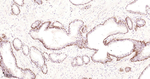 COMT Recombinant Rabbit Monoclonal Antibody (1B7)
