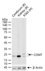 COMT Antibody in Western Blot (WB)