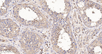 METAP2 Antibody in Immunohistochemistry (Paraffin) (IHC (P))