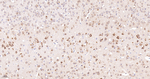 RACK1 Antibody in Immunohistochemistry (Paraffin) (IHC (P))