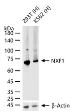 TAP Recombinant Rabbit Monoclonal Antibody (11E6)